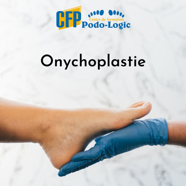 Onychoplastie